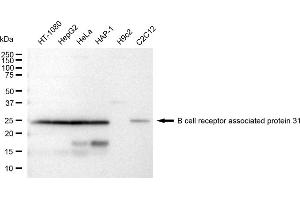 Western blotting analysis using B cell receptor associated protein 31 antibody (ABIN7797723). (Recombinant BCAP31 anticorps)