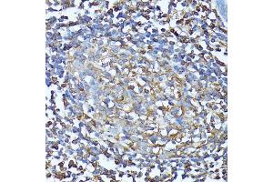Immunohistochemistry of paraffin-embedded human colon using CXCR1 antibody (ABIN7266317) at dilution of 1:100 (40x lens).