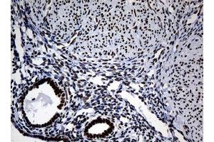 Image no. 2 for anti-Nibrin (NBN) (AA 461-754) antibody (ABIN1491540)