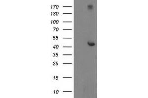 Western Blotting (WB) image for anti-Adaptor-Related Protein Complex 2, mu 1 Subunit (AP2M1) (AA 97-383) antibody (ABIN1491719) (AP2M1 anticorps  (AA 97-383))
