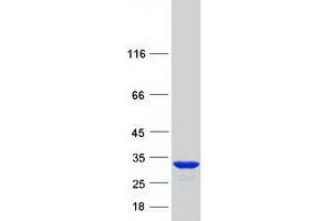 Validation with Western Blot