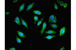 Immunofluorescent analysis of Hela cells using ABIN7162969 at dilution of 1:100 and Alexa Fluor 488-congugated AffiniPure Goat Anti-Rabbit IgG(H+L)