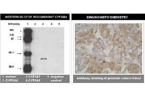 Immunohistochemistry (IHC) image for anti-Cytochrome P450, Family 3, Subfamily A, Polypeptide 7 (CYP3A7) (C-Term) antibody (ABIN264501)