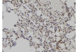 ABIN6272516 at 1/100 staining Rat lung tissue by IHC-P. (MAGED2 anticorps  (N-Term))