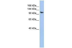 WB Suggested Anti-RNF20 Antibody Titration:  0.