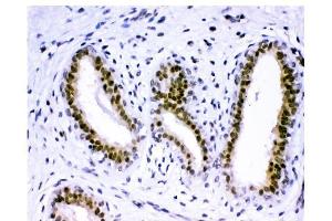 IHC analysis of KDM5B using anti-KDM5B antibody (ABIN4886648). (KDM5B anticorps  (Middle Region))