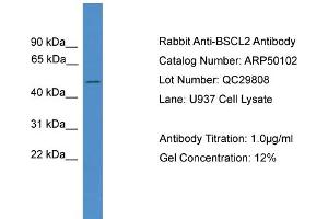 WB Suggested Anti-BSCL2  Antibody Titration: 0. (BSCL2 anticorps  (C-Term))