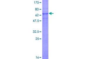 Image no. 1 for Ceroid-Lipofuscinosis, Neuronal 3 (CLN3) (AA 1-438) protein (GST tag) (ABIN1349719)
