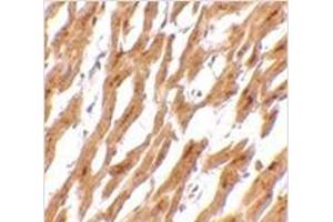 Immunohistochemistry of ASAH1 in human heart tissue with ASAH1 antibody at 2.