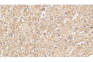 Detection of GLb in Human Spinal cord Tissue using Polyclonal Antibody to Galactosidase Beta (GLb)