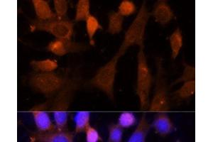 Immunofluorescence analysis of NIH-3T3 cells using VPS26A Polyclonal Antibody at dilution of 1:100 (40x lens).