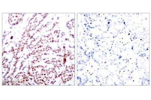 Image no. 1 for anti-Activating Transcription Factor 2 (ATF2) (pThr55), (pThr73) antibody (ABIN196668) (ATF2 anticorps  (pThr55, pThr73))