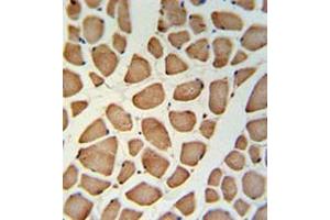 Immunohistochemistry analysis in skeletal muscle (Formalin-fixed, Paraffin-embedded) using TECR / GPSN2  Antibody (C-term), followed by peroxidase conjugation of the secondary antibody and DAB staining. (TECR anticorps  (C-Term))