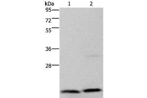 Western Blot analysis of Jurkat and PC3 cell using MCTS1 Polyclonal Antibody at dilution of 1:200 (MCTS1 anticorps)
