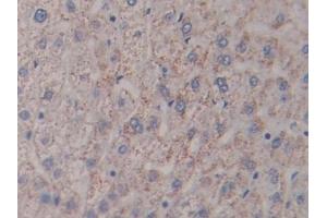 Detection of NPHN in Human Liver Tissue using Polyclonal Antibody to Nephrin (NPHN)