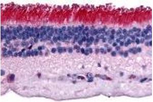 Immunohistochemistry (IHC) image for anti-Protein Tyrosine Phosphatase, Receptor Type, M (PTPRM) (Internal Region) antibody (ABIN2469323)