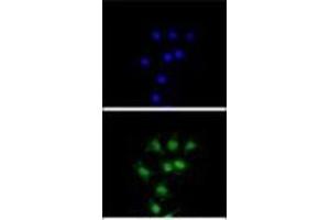 Confocal immunofluorescent analysis of FANCC Antibody (C-term) Cat.