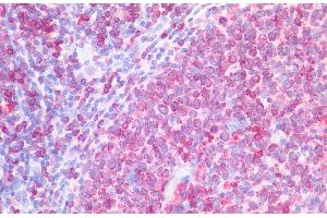 ABIN2613403 (5 μg/mL) staining of paraffin embedded Human Tonsil. (CD74 anticorps  (Internal Region))
