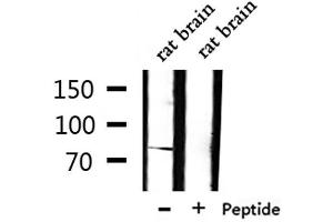 Western blot analysis of extracts from rat brain, using TLE1 Antibody.