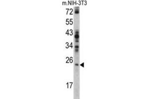 Western Blotting (WB) image for anti-RAN, Member RAS Oncogene Family (RAN) antibody (ABIN3002753)
