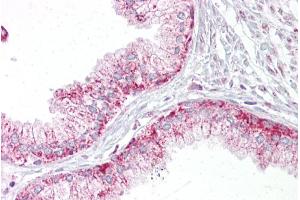 Immunohistochemistry with Prostate tissue at an antibody concentration of 5µg/ml using anti-AURKA antibody (ARP30876_P050) (Aurora A anticorps  (C-Term))