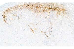 anti-Calcitonin-Related Polypeptide alpha (CALCA) antibody