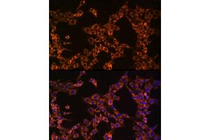 Immunofluorescence analysis of PC-12 cells using UB Rabbit mAb (ABIN7271128) at dilution of 1:50 (40x lens). (UBA52 anticorps)