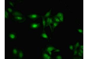 Immunofluorescent analysis of Hela cells using ABIN7168309 at dilution of 1:100 and Alexa Fluor 488-congugated AffiniPure Goat Anti-Rabbit IgG(H+L) (RBMY1A1 anticorps  (AA 1-459))
