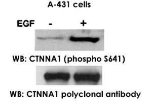 Western blot analysis of extract from A-431 cells, untreated ortreated with EGF (200ng/ml, 30min), using CTNNA1 polyclonal antibody  and CTNNA1 (phospho S641) polyclonal antibody . (CTNNA1 anticorps  (pSer641))