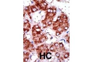 anti-Carnitine Palmitoyltransferase 1B (Muscle) (CPT1B) (AA 606-637), (C-Term) antibody