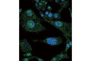 Confocal immunofluorescent analysis of NOTCH3 Antibody (C-term) (ABIN390159 and ABIN2840656) with HepG2 cell followed by Alexa Fluor 488-conjugated goat anti-rabbit lgG (green).