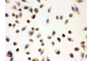 IHC testing of FFPE human SMMC-7721 cells with ERAB antibody.