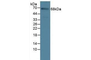 Detection of IL23R in Rat Serum Tissue using Polyclonal Antibody to Interleukin 23 Receptor (IL23R)