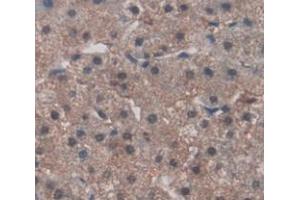 IHC-P analysis of Human Tissue, with DAB staining. (FNDC5 anticorps  (AA 2-137))