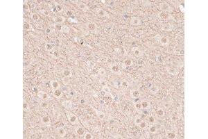 Immunohistochemistry of paraffin-embedded Mouse brain using VEGF Receptor 2 Polyclonal Antibody at dilution of 1:100 (40x lens). (VEGFR2/CD309 anticorps)