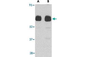 Western blot analysis of UNC93B1 in human heart tissue lysate with UNC93B1 polyclonal antibody  at (A) 0.