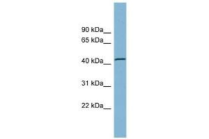 TBC1D13 antibody used at 1 ug/ml to detect target protein. (TBC1D13 anticorps  (Middle Region))