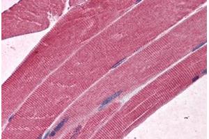 Human Skeletal muscle: Formalin-Fixed, Paraffin-Embedded (FFPE) (MBNL1 anticorps  (AA 1-383))