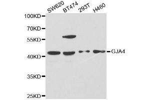 Western blot analysis of extracts of various cell lines, using GJA4 antibody. (GJA4 anticorps  (AA 229-333))