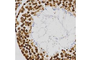 Immunohistochemistry (IHC) image for anti-Histone H4 (3meLys20) antibody (ABIN3016051)