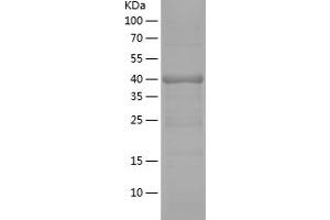 Western Blotting (WB) image for Adenylate Cyclase 3 (ADCY3) (AA 400-576) protein (His-IF2DI Tag) (ABIN7121714)
