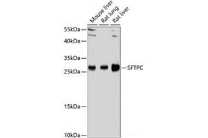 Western blot analysis of extracts of various cell lines using SFTPC Polyclonal Antibody at dilution of 1:1000. (Surfactant Protein C anticorps)