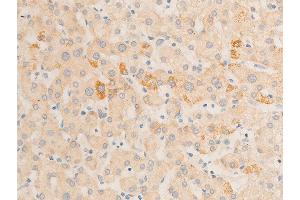 ABIN6267070 at 1/100 staining human liver tissue sections by IHC-P.