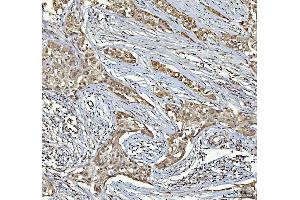 IHC analysis of RTCB using anti-RTCB antibody (ABIN7600722). (C22orf28 anticorps  (AA 227-505))