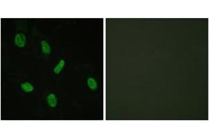 Immunofluorescence analysis of HeLa cells, using Androgen Receptor (Ab-94) Antibody.