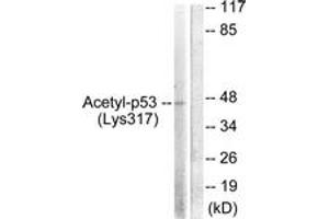Western blot analysis of extracts from HeLa cells, treated with TSA 400nM 24h, using p53 (Acetyl-Lys317) Antibody. (p53 anticorps  (acLys317))