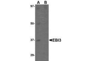 Image no. 2 for anti-Interleukin-27 subunit beta (IL-27b) (C-Term) antibody (ABIN341717) (EBI3 anticorps  (C-Term))