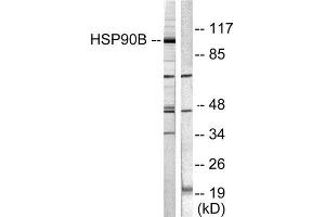 Western Blotting (WB) image for anti-Heat Shock Protein 90kDa alpha (Cytosolic), Class B Member 1 (HSP90AB1) (Ser254) antibody (ABIN1847890)
