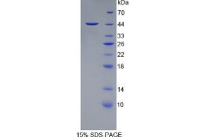 SDS-PAGE analysis of Human PTPRC Protein. (CD45 Protéine)