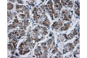 Immunohistochemistry (IHC) image for anti-Bruton Agammaglobulinemia tyrosine Kinase (BTK) antibody (ABIN1496971) (BTK anticorps)